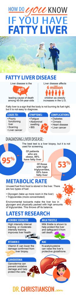 Infographic_FattyLiver-261x1024
