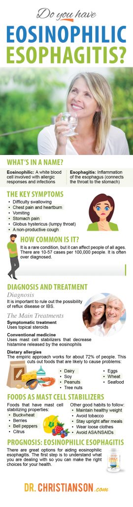 infographic_Eos-Esophagus-270x1024