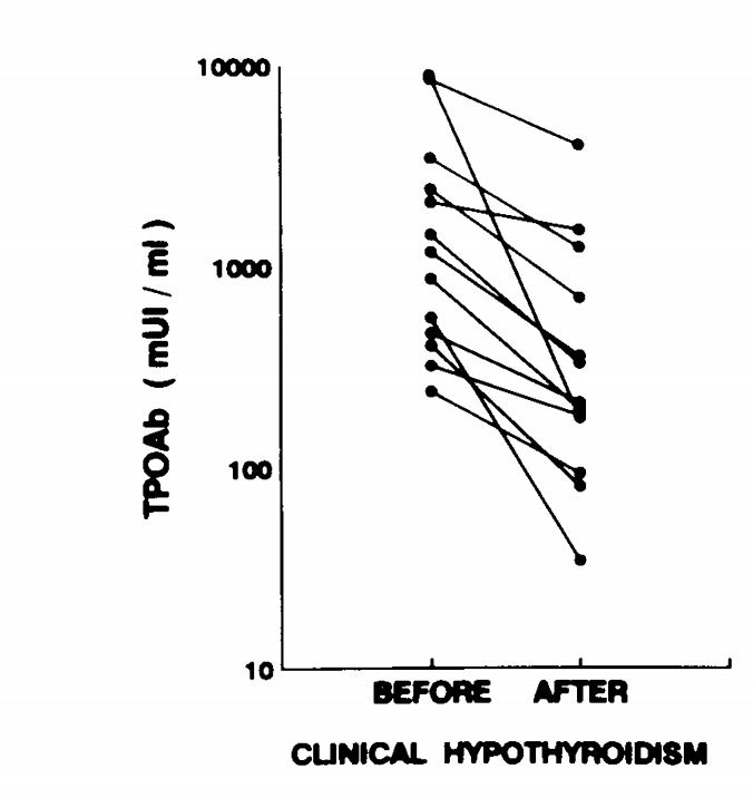 clinical-hypothyroidism
